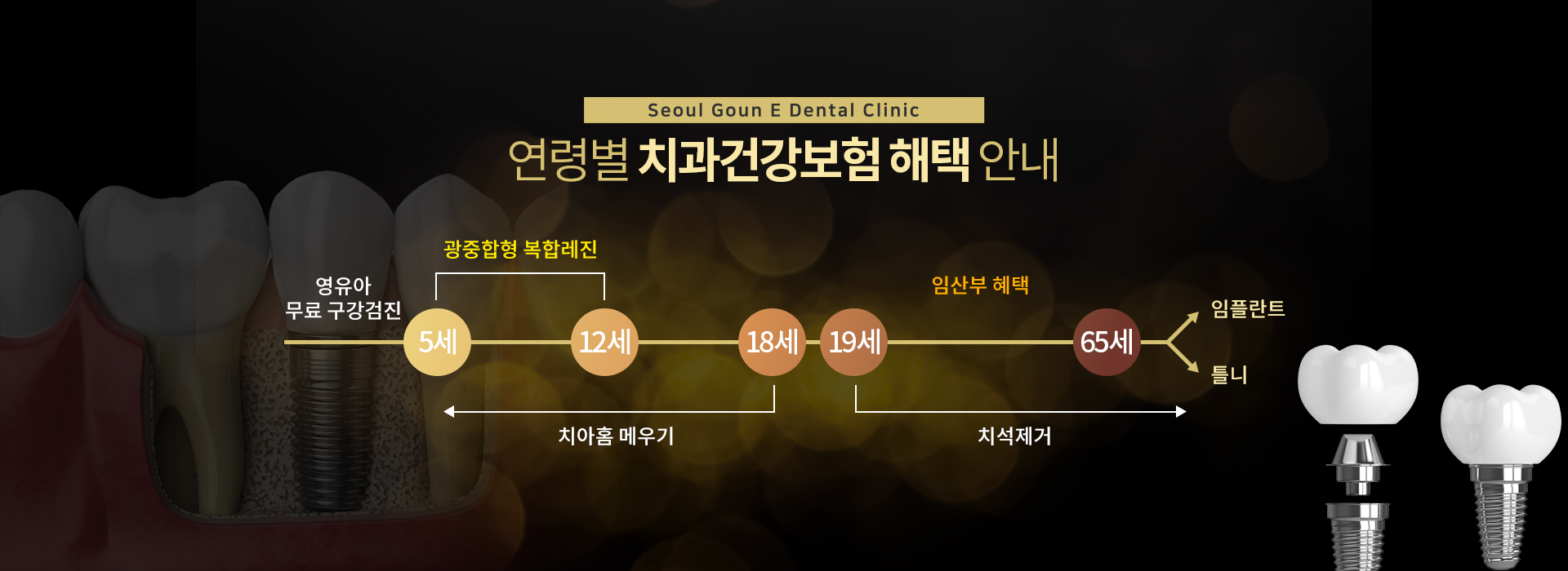 연령별 치과건강보험 혜택