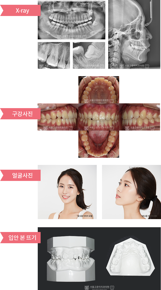 X-ray, 구내외 사진 찍기, 구강 본뜨기 등